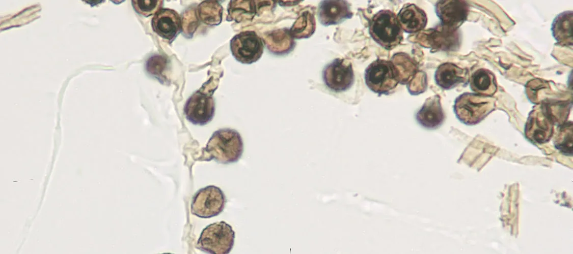Gallery image 3 — fungal analysis Phoenix
