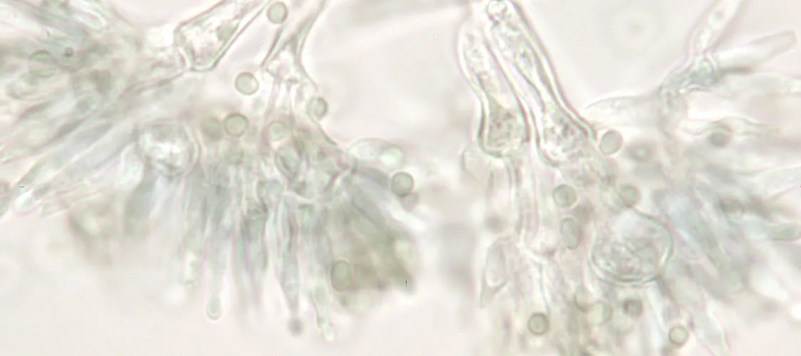 Gallery image 5 — fungal analysis Phoenix