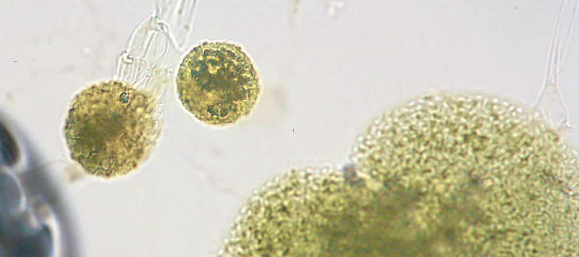 Gallery image 6 — fungal analysis Phoenix