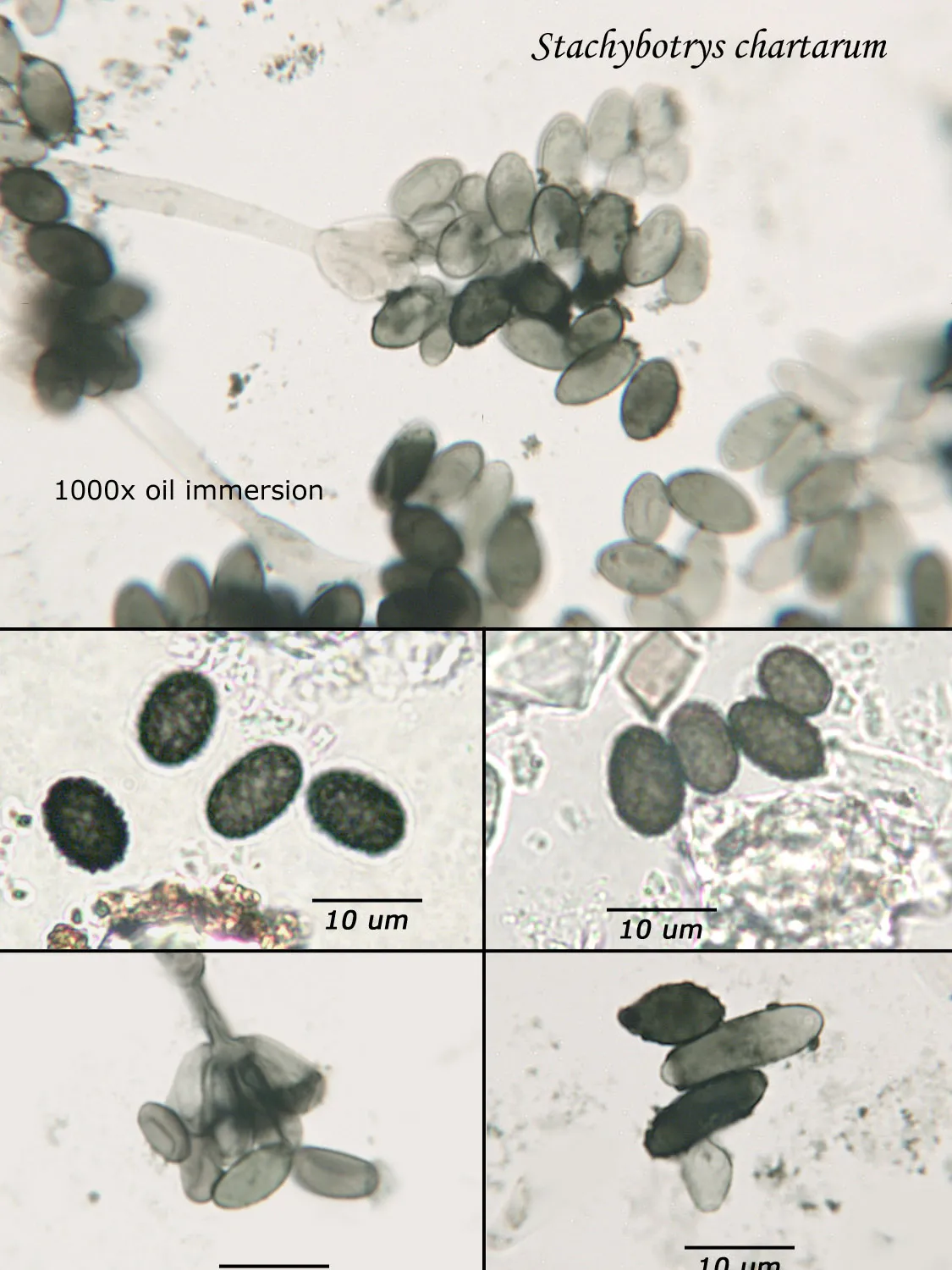Gallery image 7 — fungal analysis Phoenix
