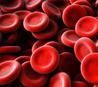 Gallery image 10 — blood cleanup services Miami