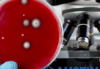 Gallery image 2 — residential mold inspection Austin Mold Testing